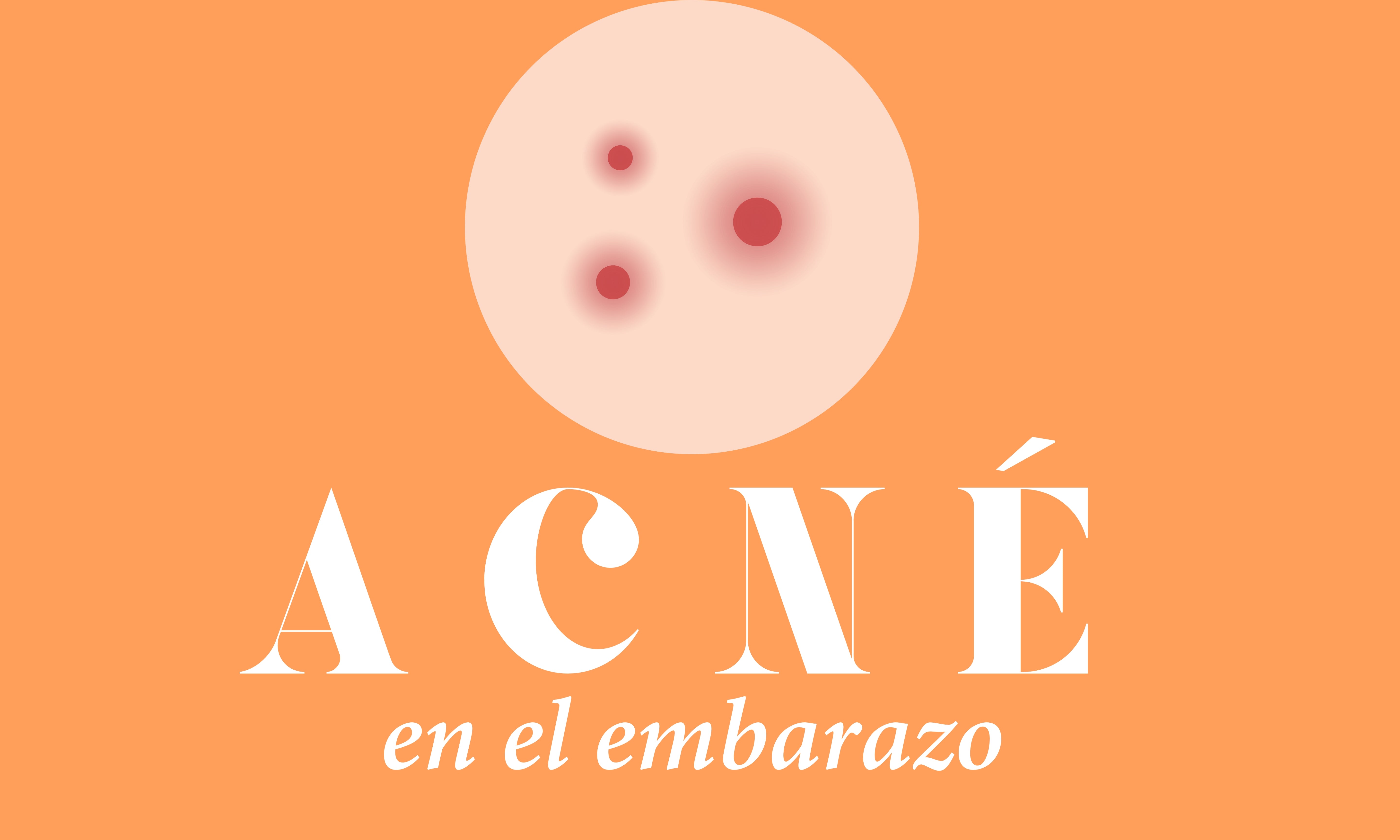 Acné en el embarazo