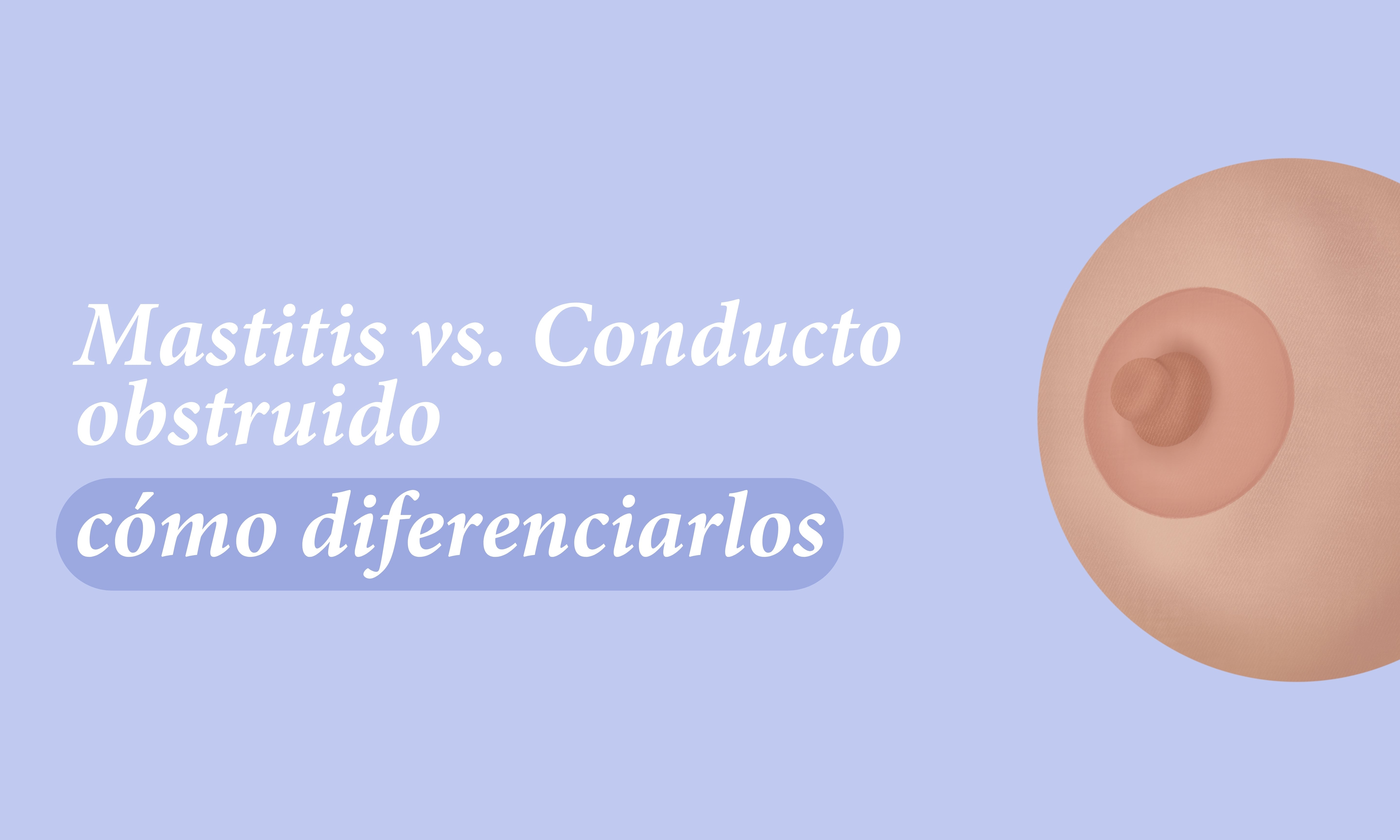 Mastitis vs. Conducto obstruido (¿cómo diferenciarlos?)
