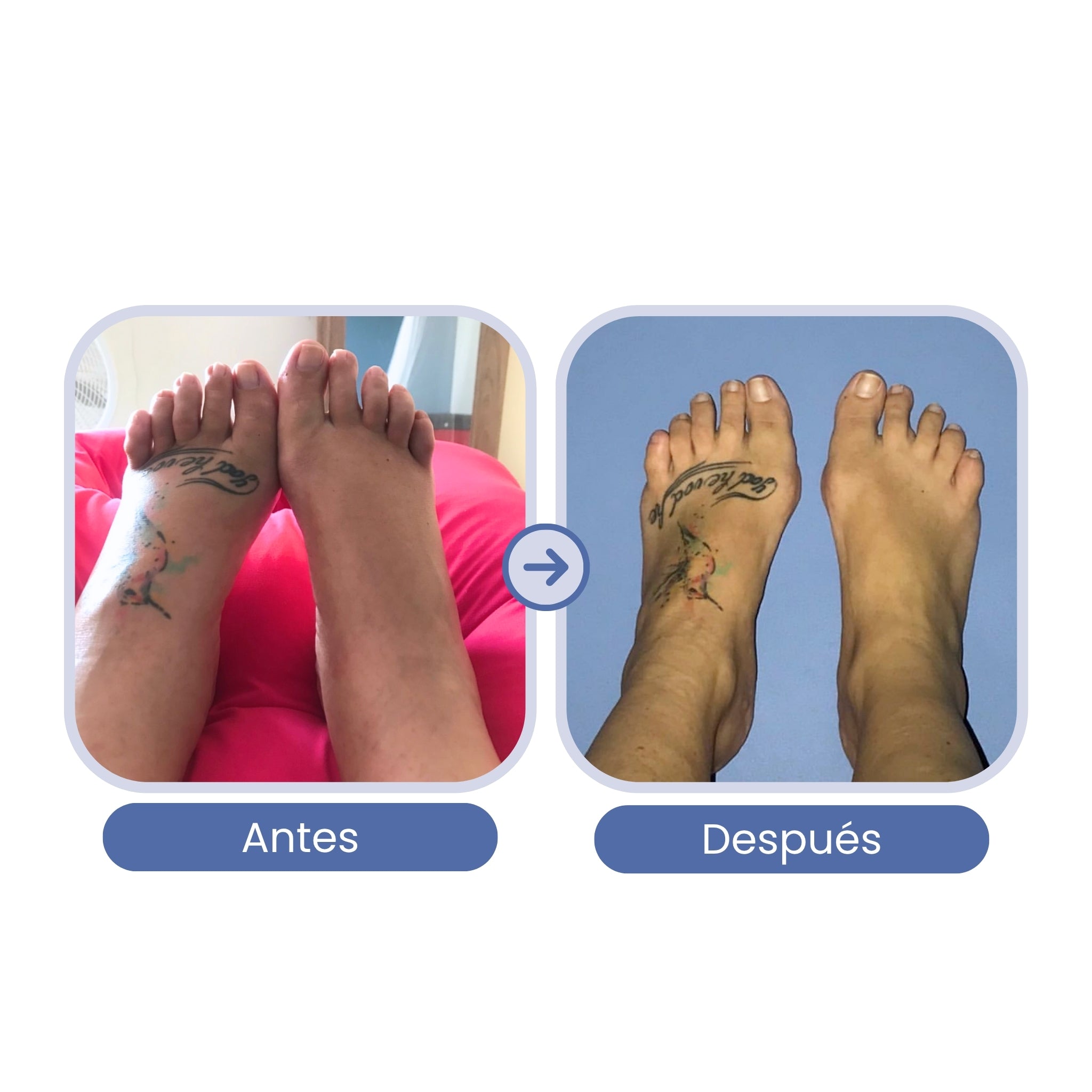 Regenerador del Tejido del Útero