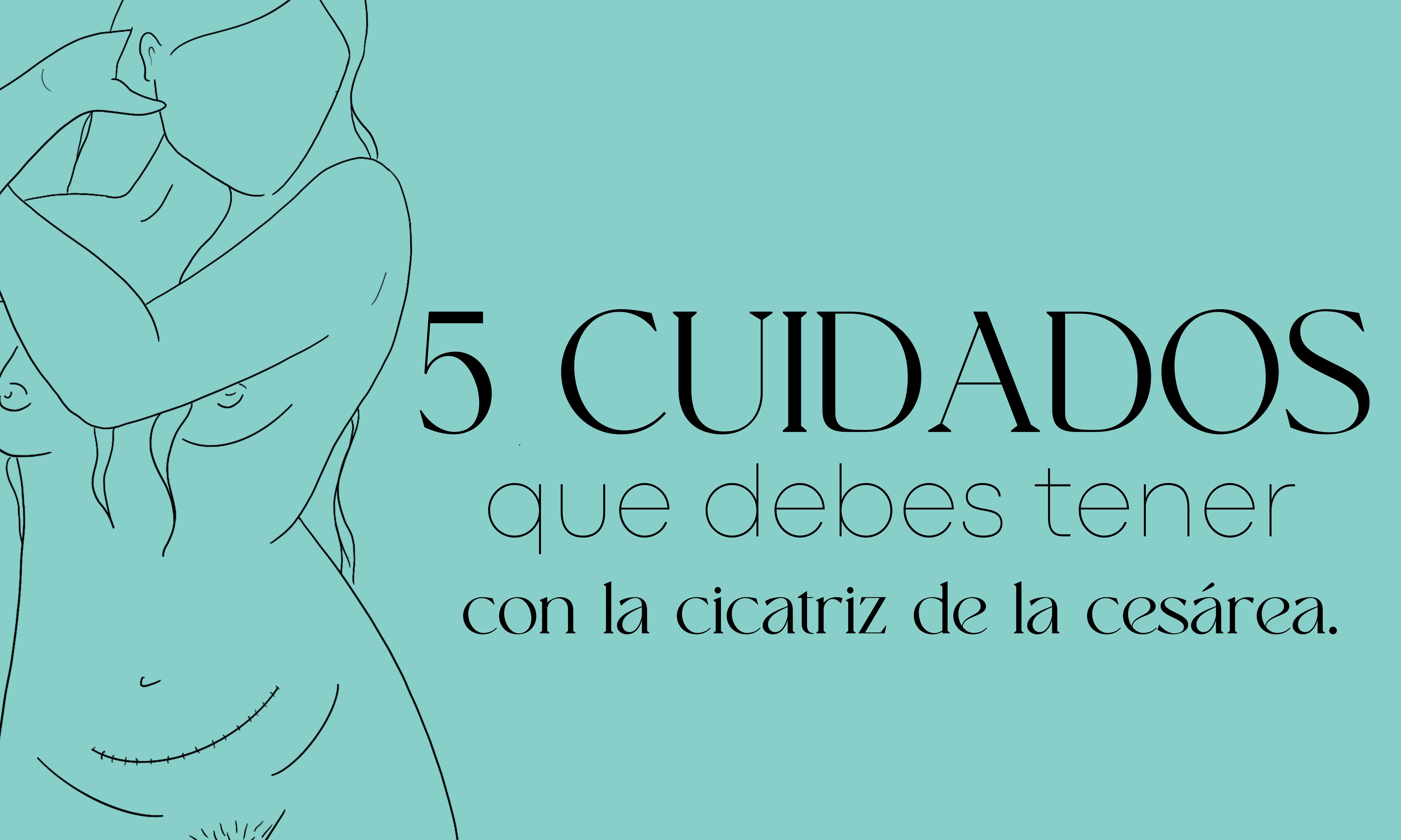 5 Cuidados que debes tener con la cicatriz de la cesárea